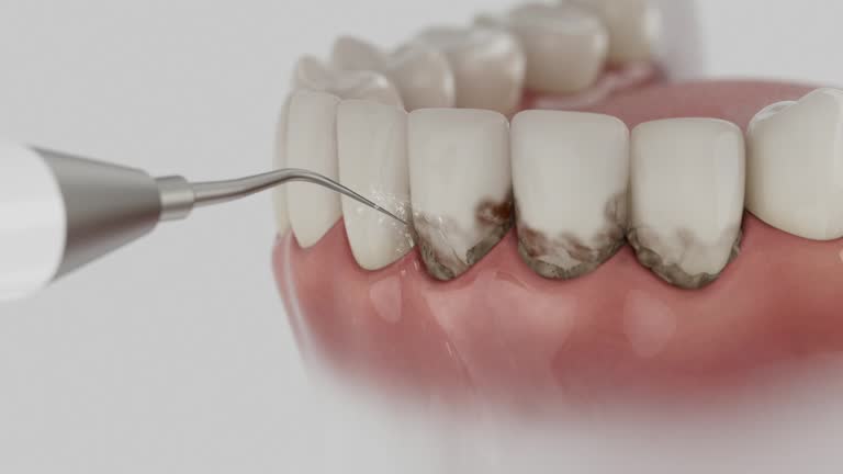 Trusted Emergency Dentist service in Parchment, MI - Dentist Open Now